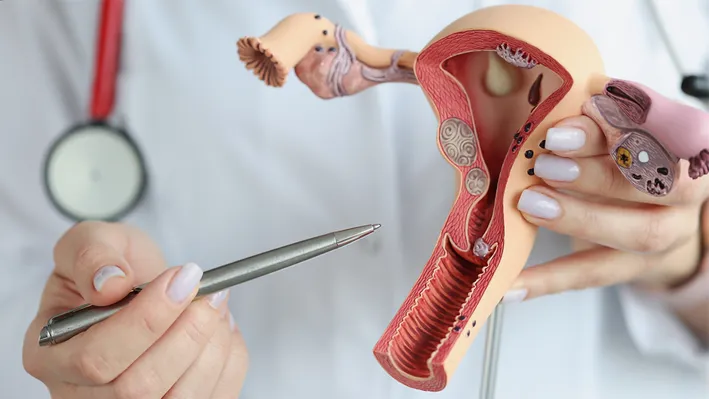 fibroid-treatment-in-dubai