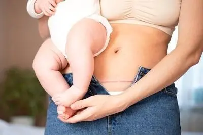 vbac-delivery-in-dubai