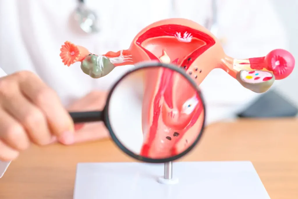 uterine-polyps-affecting-fertility