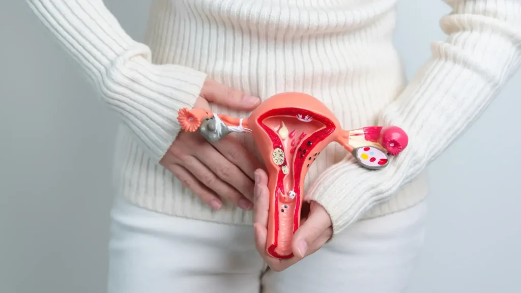 vaginal-prolapse