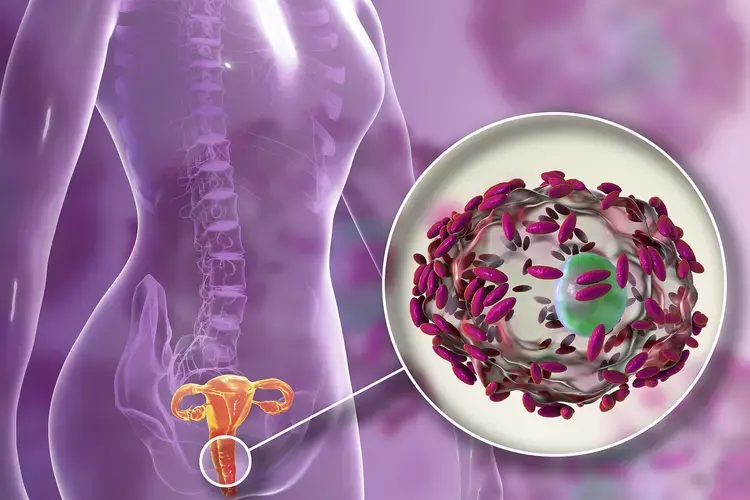 bacterial-vaginosis